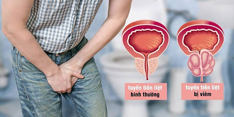 benh-tien-liet-tuyen